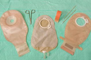 三个造口袋，用于回肠造口患者，使用胶带、剪刀和拭子”></noscript>
          </div>
         </div>
        </div>
        <div class=
